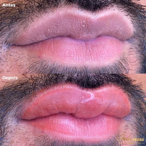 Micropigmentação labial masculina realizada no salão de beleza em Moema, São Paulo.